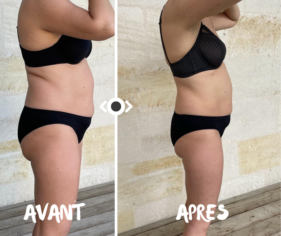 Laura : -7kg en 6 semaines